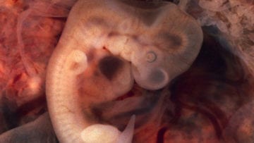 ¿Cómo saber si estoy embarazada?