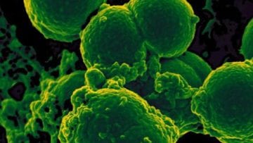 ¿Qué son bacterias patógenas?