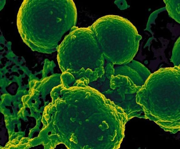 ¿Qué son bacterias patógenas?