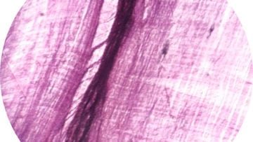 ¿Cómo se clasifican los tejidos musculares?