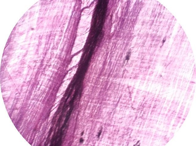 ¿Cómo se clasifican los tejidos musculares?