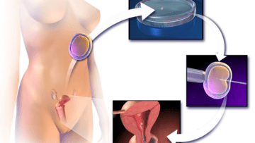 ¿Cuáles son las técnicas de reproducción asistida?