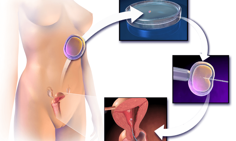 ¿Cuáles son las técnicas de reproducción asistida?