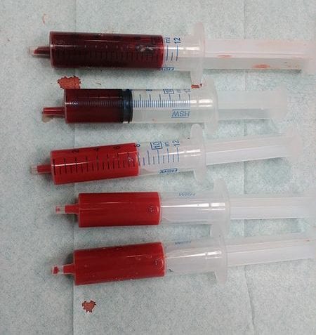 ¿Cuáles son los grupos sanguíneos?