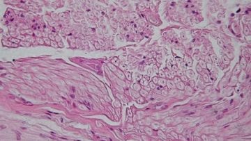 ¿Qué es el tejido nervioso?