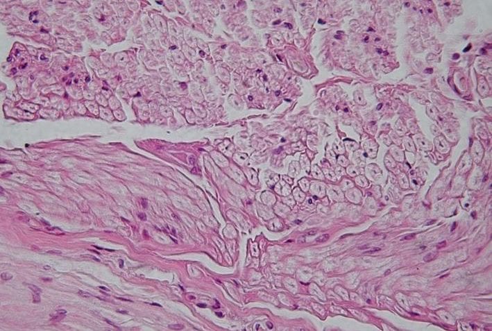 ¿Qué es el tejido nervioso?