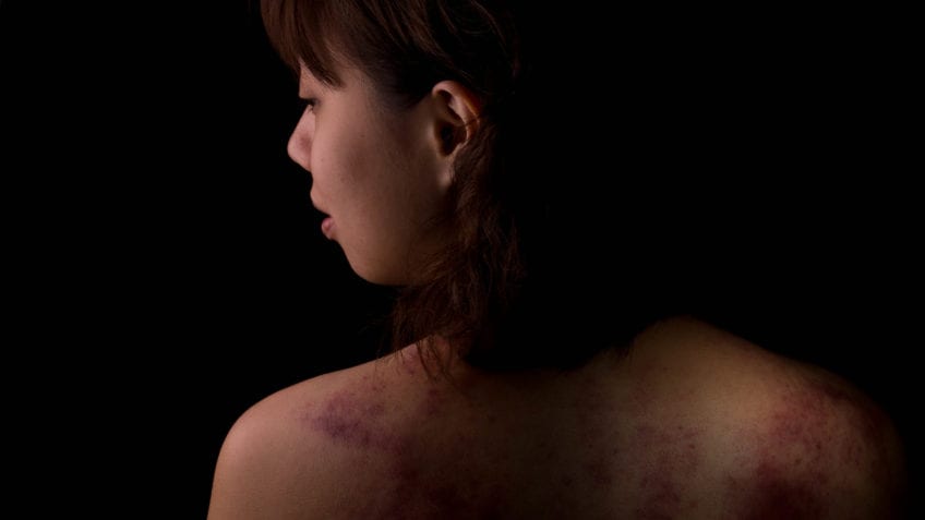 ¿Cuáles son los tipos de violencia intrafamiliar?